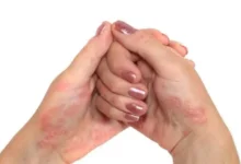 25 6