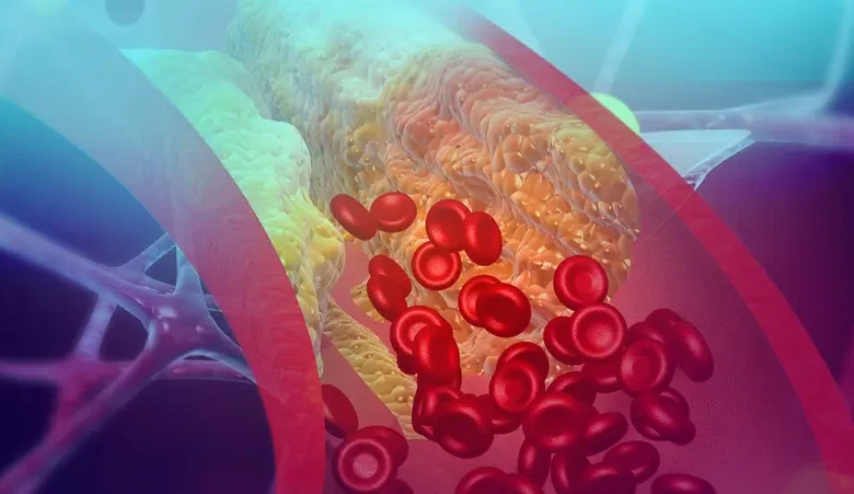 بدائل طبيعية: 5 أطعمة تعالج أضرار الشرايين في المراحل المبكرة وتخفض ضغط الدم 1 34 2