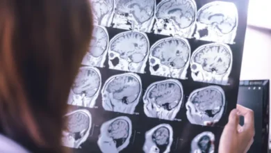 سلاح جديد لمواجهة "مرض النسيان".. كيف يحمي قلبك عقلك من الزهايمر؟ 2 3 16