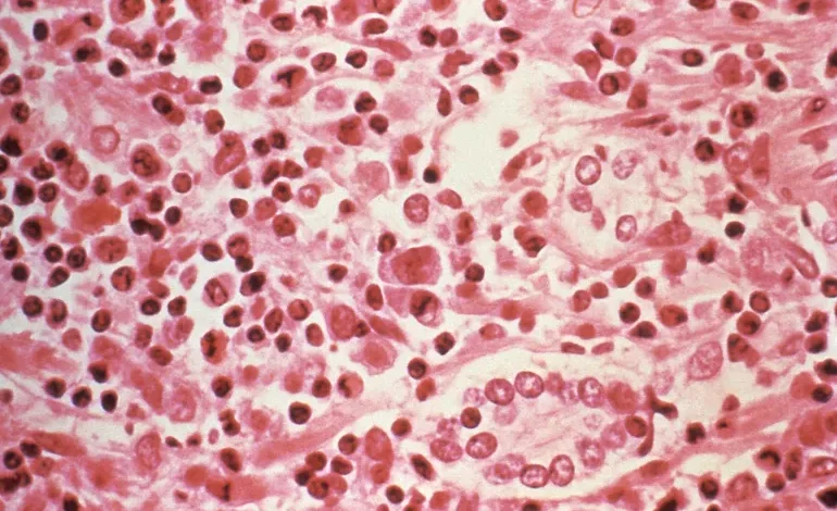 فيروس هانتا القاتل: القصة الكاملة لتفشي "Hantavirus" على سفينة سياحية وأعراضه وطرق الوقاية 1 reuters 69f8b389 1777906569