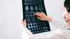 السكتة الدماغية تهاجم الشباب 2 d8a7d984d8b3d983d8aad8a9 d8a7d984d8afd985d8a7d8bad98ad8a9 d8aad987d8a7d8acd985 d8a7d984d8b4d8a8d8a7d8a8