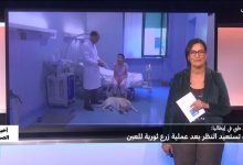 استعادة البصر بعد سنوات من العمى بعملية جراحية مبتكرة 2 d8a7d8b3d8aad8b9d8a7d8afd8a9 d8a7d984d8a8d8b5d8b1 d8a8d8b9d8af d8b3d986d988d8a7d8aa d985d986 d8a7d984d8b9d985d989 d8a8d8b9d985d984d98a